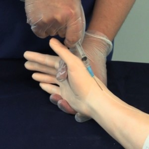 Cortisone steroid injection wrist